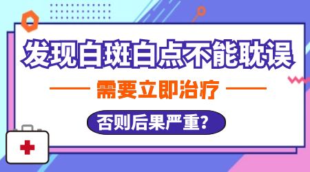 白癜风治治停停会有什么影响?